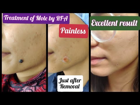 Grace Clinic video