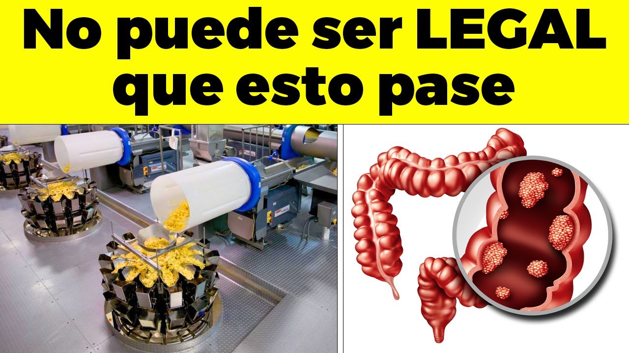 17 alimentos ultraprocesados QUE MÁS MATAN y nadie te lo dice