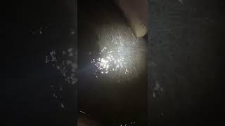 Check this out! Mass migration off glass eels!! (anguilla anguilla) river Parrett.