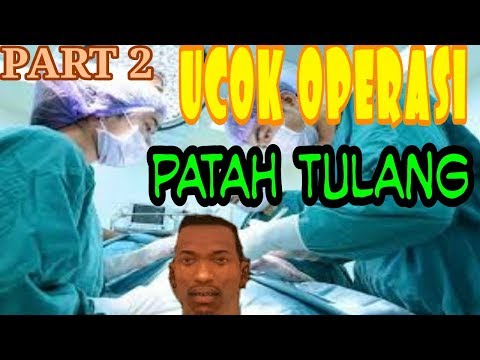 Tulang Ucok Patah Part 2- GTA EXTREAM INDONESIA