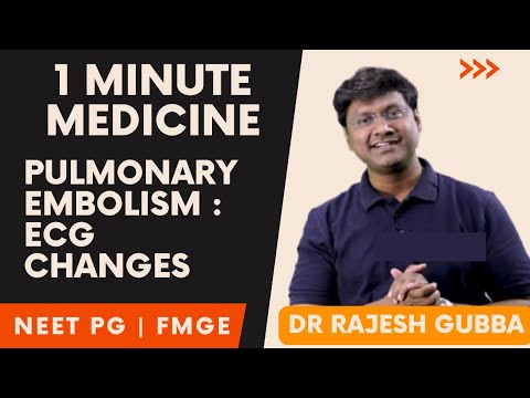 Medicine in 1 Minute : Pulmonary Embolism ECG ARDS | NEET PG  FMGE Rapid Revision By Dr Rajesh Gubba