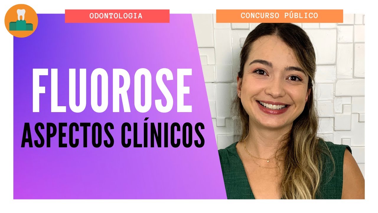FLUOROSE: ASPECTOS CLÍNICOS