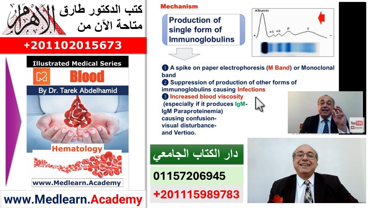 Multiple Myeloma   #cme #internal_medicine #medical #medicalstudent  #usmle #محاضرات_باطنة
