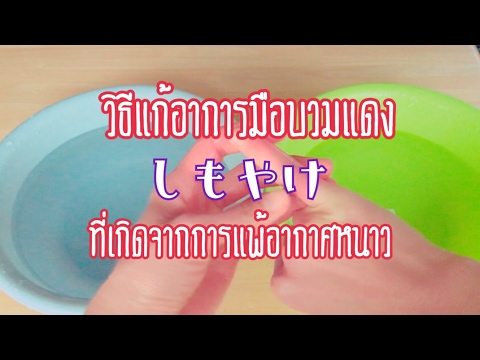 โรคสะเก็ดเงินและ neotigazon โรคระบบและโรคสะเก็ดเงิน