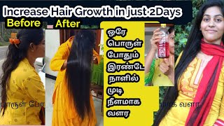 Hair growth in two days/இந்த ஒரு Hair oil போதும் முடி நீளமாக அடர்த்தியாக வளர...