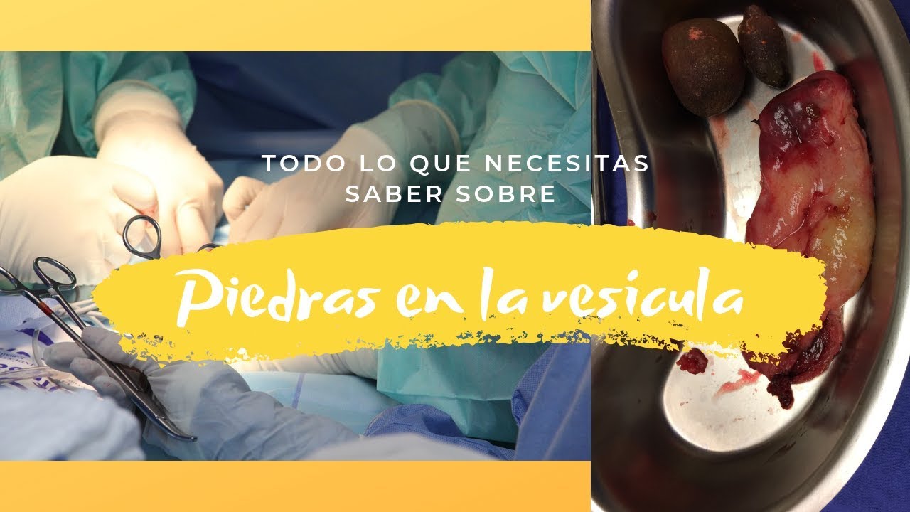 Eduardo Jafet Ruiz Suárez-22