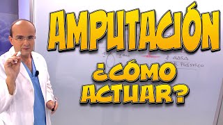AMPUTACIONES, ¿Qué pasa en el cuerpo ¿Cómo actuar - Primeros Auxilios #10