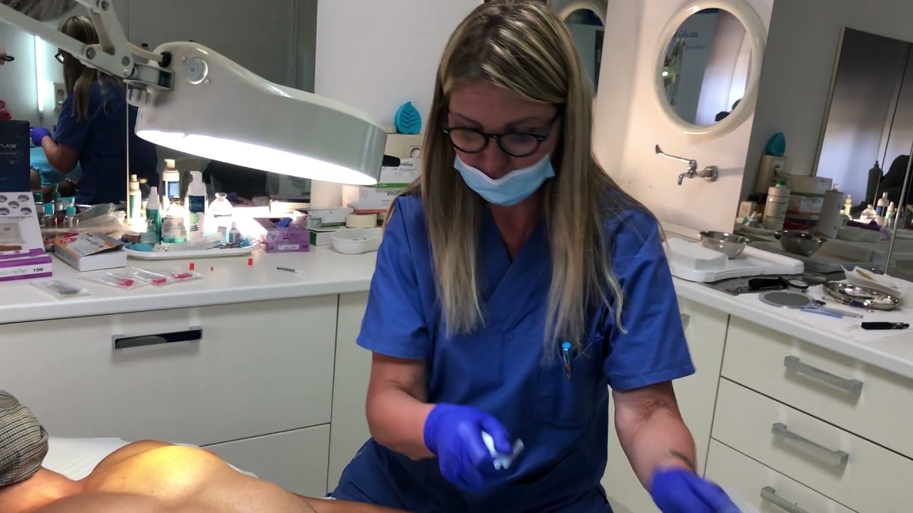 Watch Now FILI SU ADDOME MASCHILE FILI SU ADDOME MASCHILE