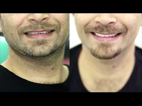 smile makeovers at IDEAL SMILE PAKISTAN
