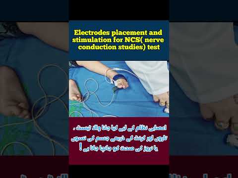 NCS-EMG test steps | Nerve conduction studies & electromyography