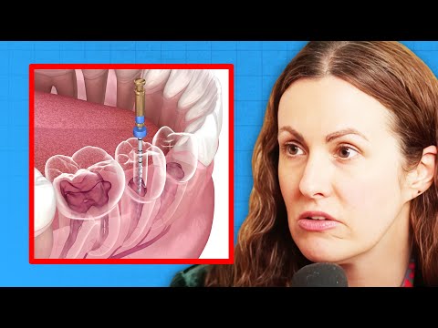 Functional Dentist REVEALS the Truth About ROOT CANALS | Dr. Staci Whitman