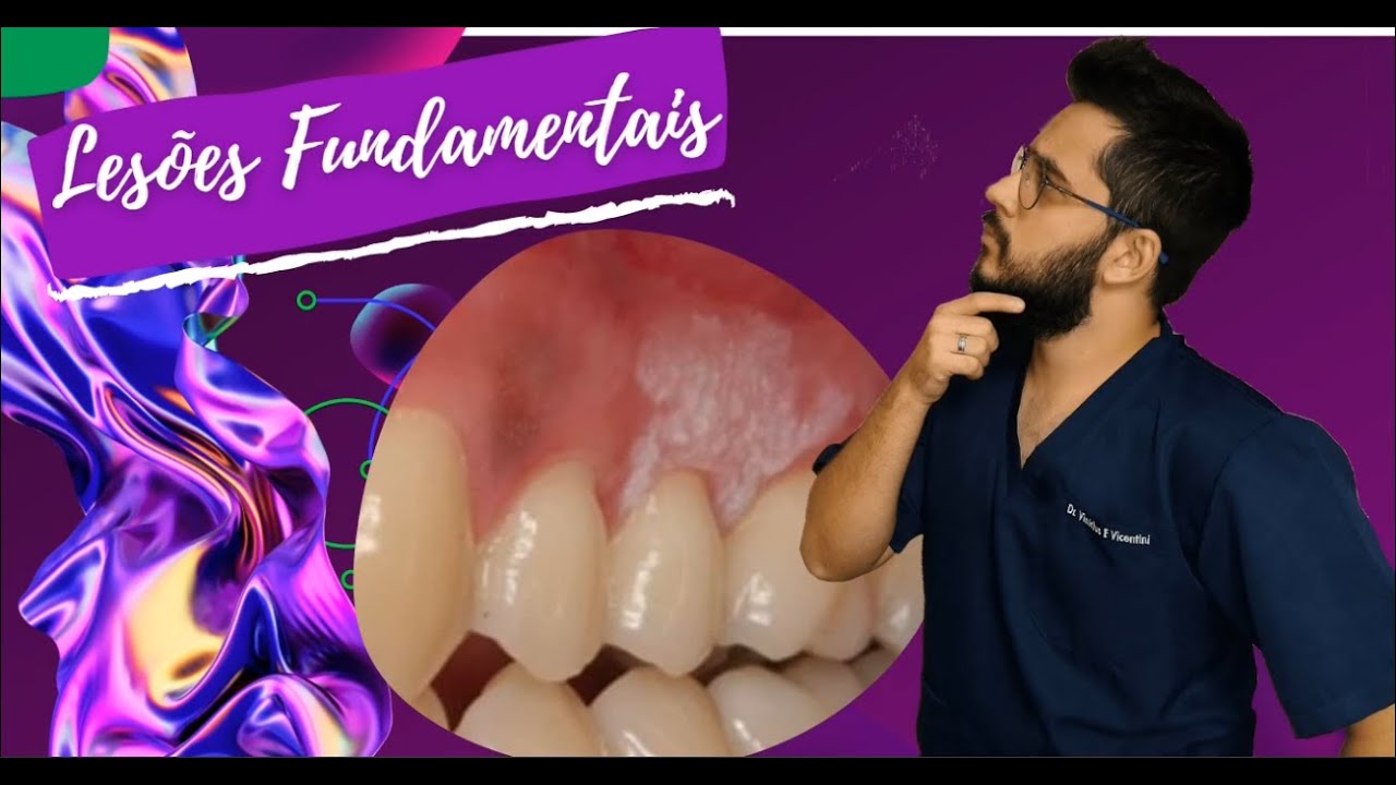 Lesões Fundamentais na Odonto(Mancha,Placa,Nódulo etc...)