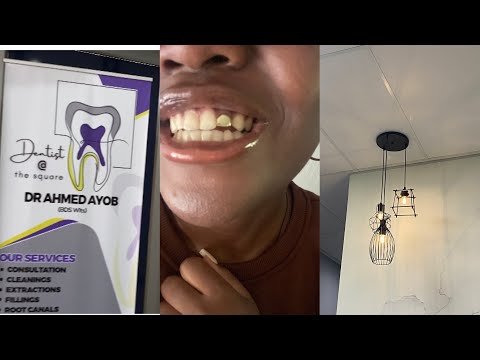 Gold tooth removal cost + procedure