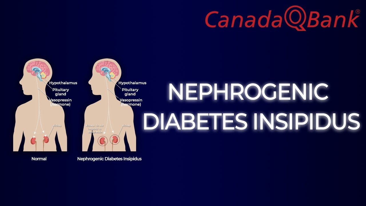 Nephrogenic Diabetes Insipidus