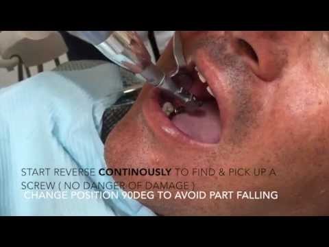 Omplant Driver How to use Dental Implants logo