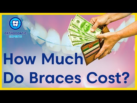 YouTube video about: How much do braces cost in utah?
