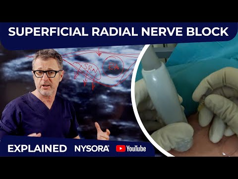 SUPERFICIAL RADIAL BLOCK: CONCEPT YOU MUST KNOW - Crash course with Dr. Hadzic