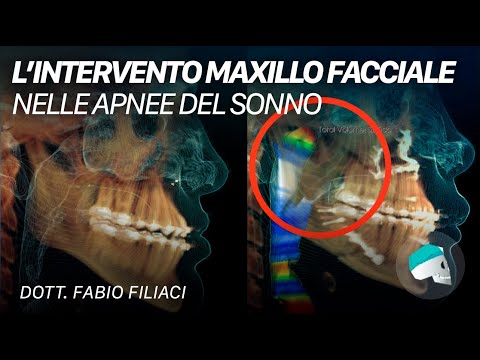 Lartrosi dellarticolazione del ginocchio e una cyclette Piega alare del ginocchio