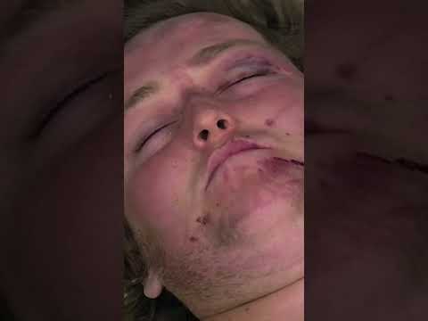 He's never going to walk again | 24 Hours in A&E | Medical Documentary