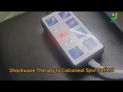 Shockwave Therapy for Calcaneal Spur