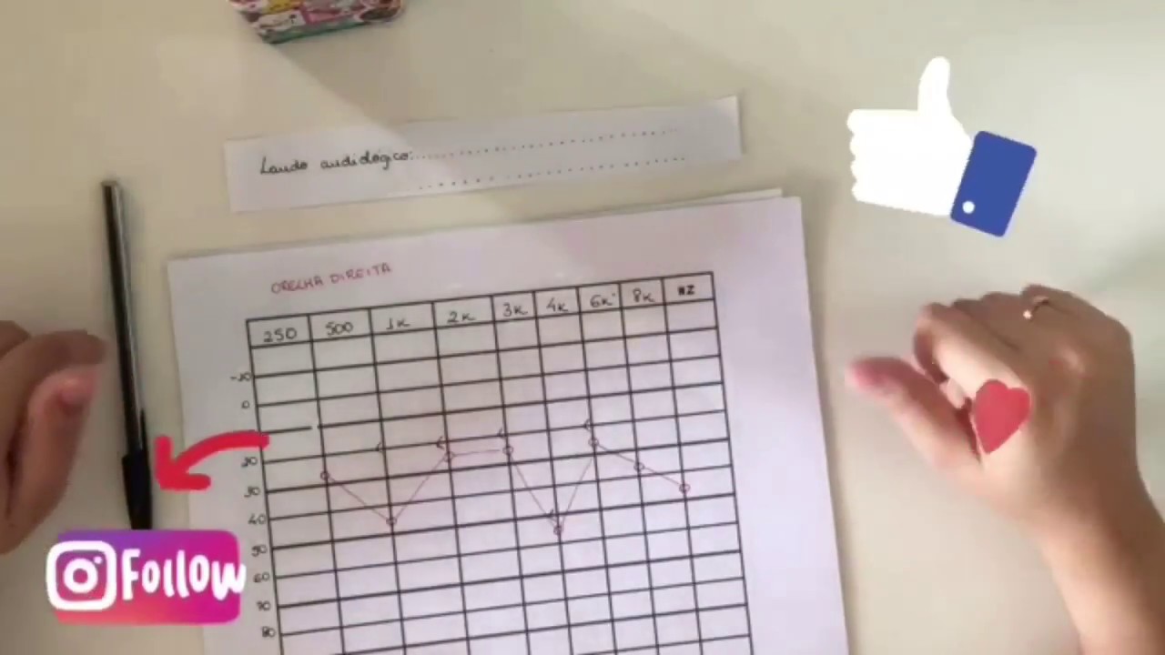 Perdas auditivas: condutiva, sensorioneural e mista. Como definir o laudo audiológico?