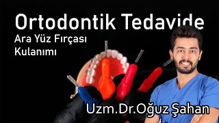 Uzm.Dr.Oğuz Şahan - Ortodontik tedavide ara yüz fırçası nasıl kullanılmalı Diş telleri temizliği