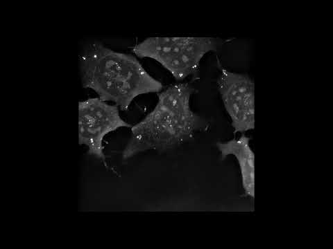 STEM CELLS: Long Term Live Imaging of Mouse Embryonic Stem Cells for 34 hours