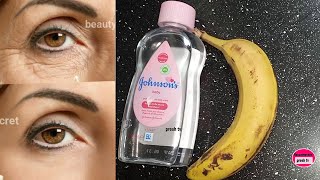 Under eye wrinkles natural Botox / How to get rid of eye wrinkles when you smile naturally