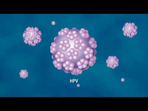 vastagbélrák terjed ellenjavallatok a papilloma vírus elleni vakcinára