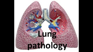 4-8 Lung pneumoconiosis - Pathology for first-year Pharmacy students