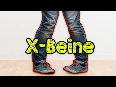 X-Beine - Übungen um sie los zu werden - Gründe warum sie erst enststehen