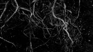 Harm of Will (Björk Cover)