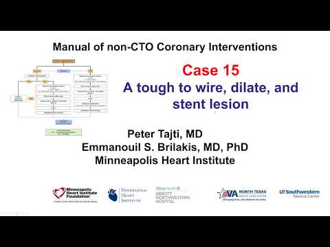 Case 15: PCI Manual - Balloon undilatable