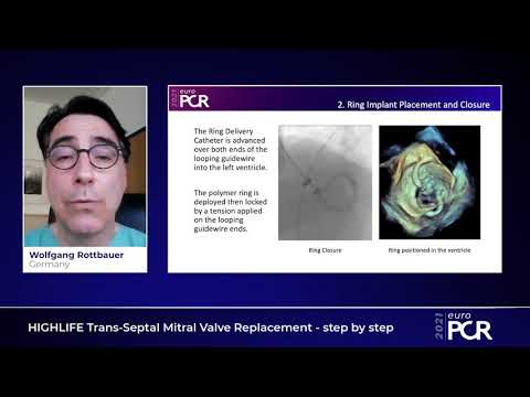 HIGHLIFE Trans-Septal Mitral Valve Replacement (TSMVR) - step by step - EuroPCR 2021