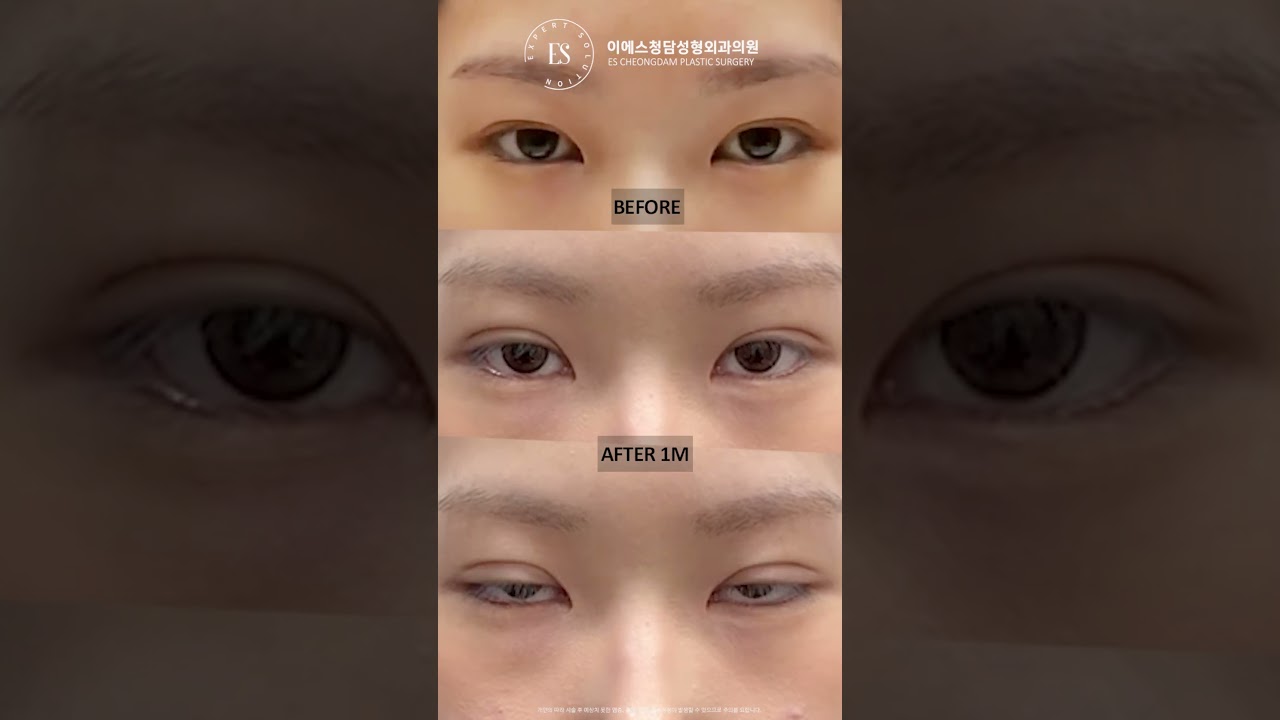 이에스 유튜브