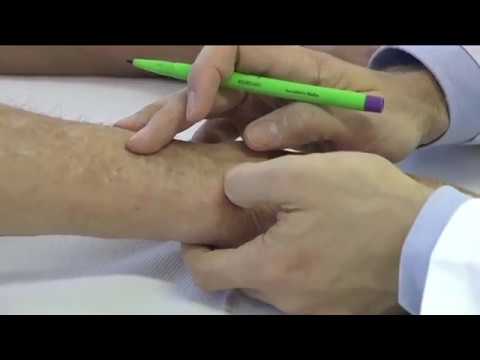 Come trattare un video cervicale ernia La pelle secca sulle articolazioni delle gambe