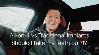 Full Arch Dental Implants vs Traditional Implants : Pros and Cons