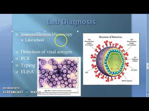 légzési papillomatosis bronchoscopia)