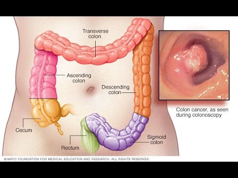 15 minutong ehersisyo para sa pagbaba ng timbang video Mababang-calorie hapunan slimming recipe na may mga larawan