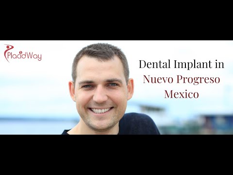 Dental Implant in Nuevo Progreso, Mexico