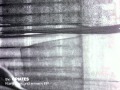 The Opiates - Anatomy of a Plastic Girl (Chris ...