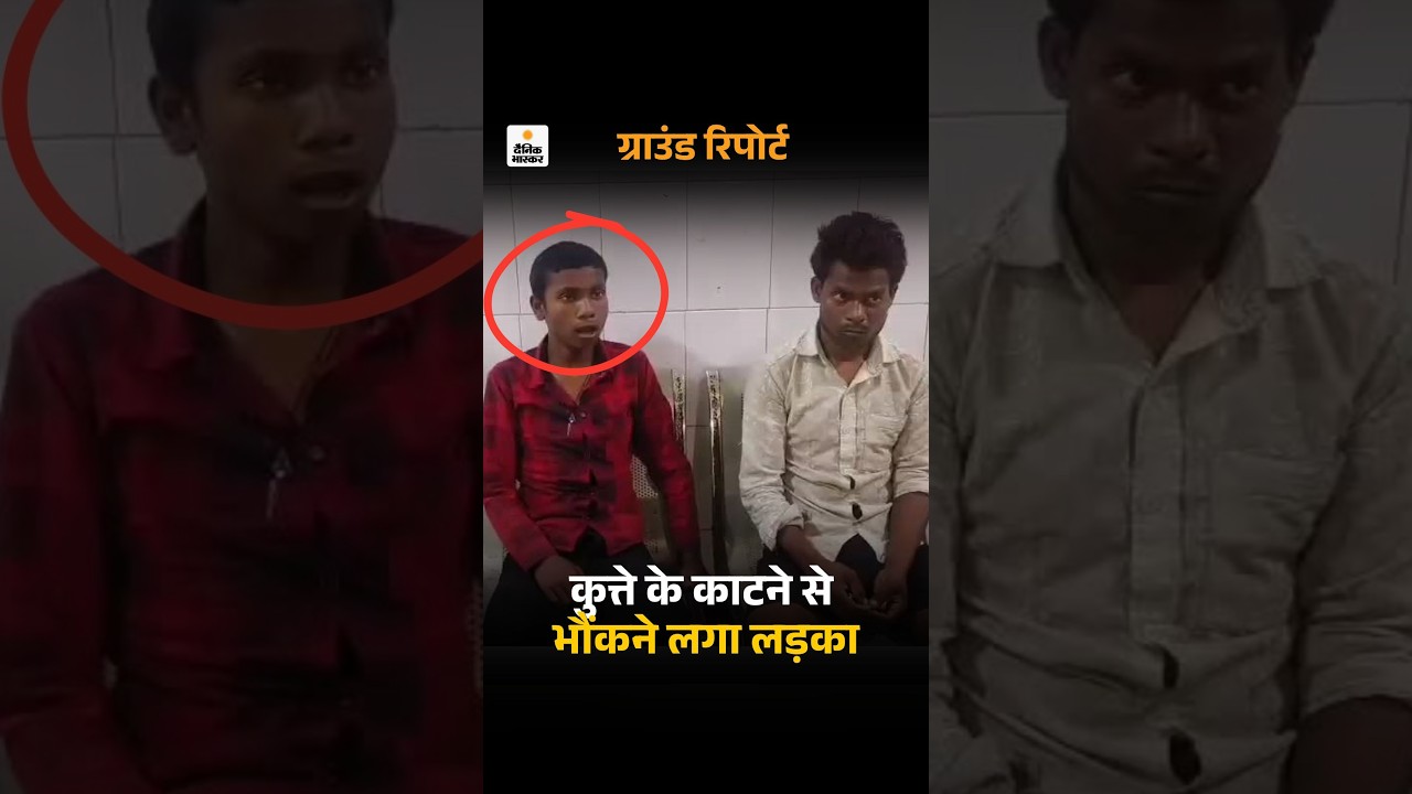 UP DogBite Survivor: मिर्जापुर में कुत्ते के काटने से भौंकने लगा लड़का