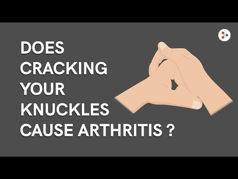 Kanyargós kezelés arthrosis