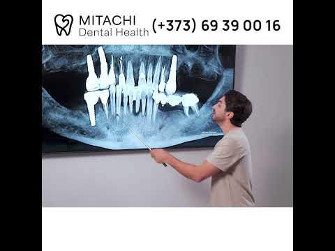 Cum am rezolvat un caz real: dureri, infecții, masticație dificilă