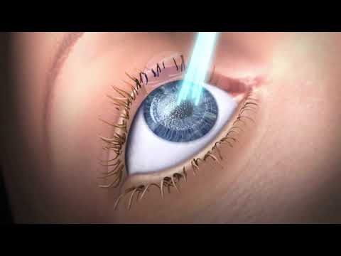 Gyógyító videó a látáshoz