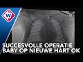 LUMC opent nieuwe afdeling voor alles voor het hart: CVIC