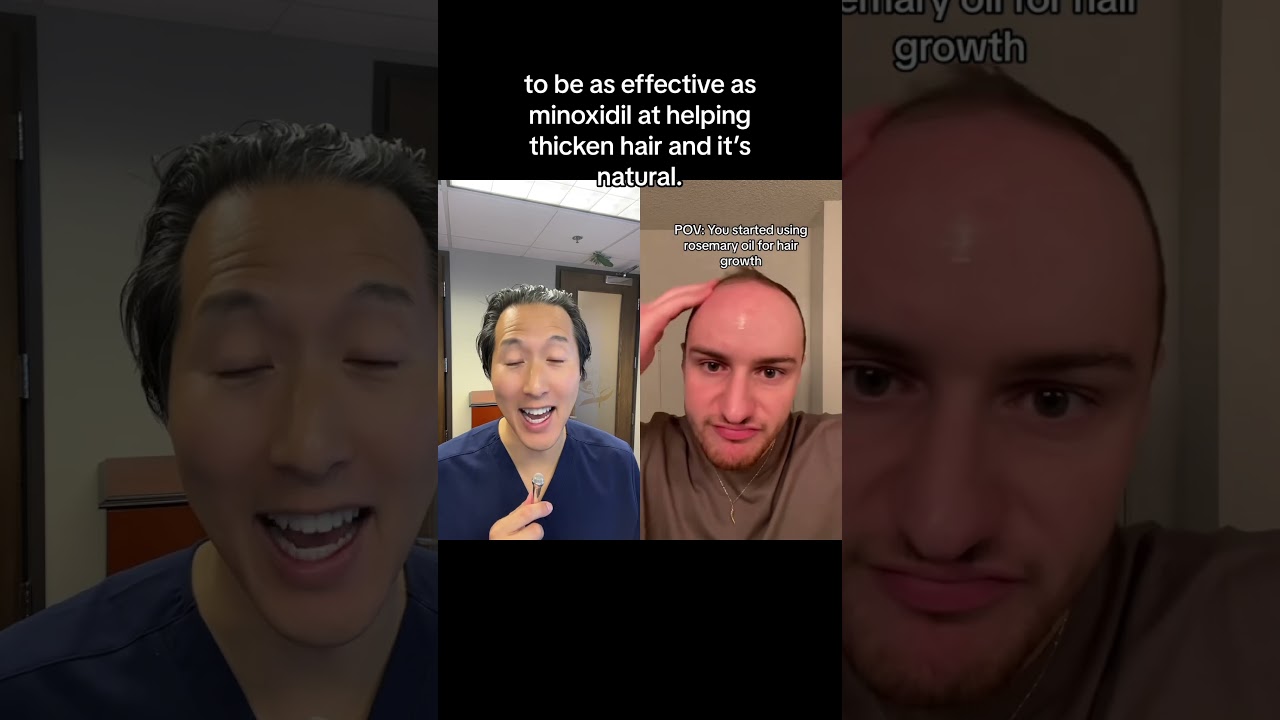 Does Rosemary Oil Help With Hair Growth? #rosemaryoil