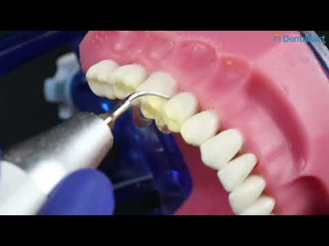 Waldent Ultrasonic Scaler Handpiece with LED | EMS Compatible | Best Dental Scaler for Clinics