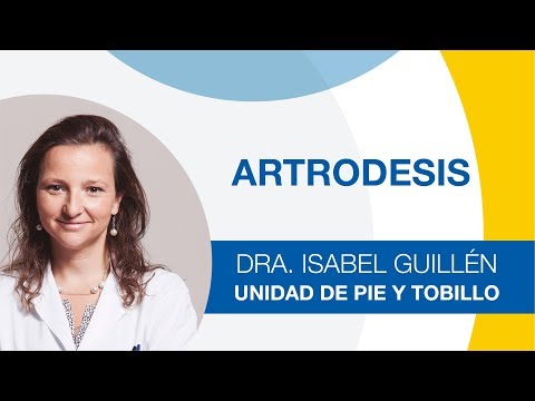 Artrodesis de Tobillo