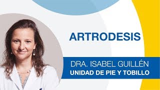 Artrodesis de Tobillo